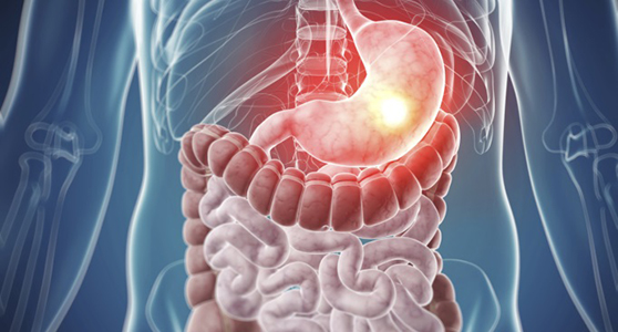 Gastro-Intestinal (GI) Cancer