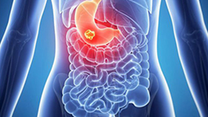 Gastro-Intestinal Cancer