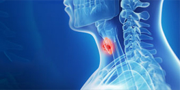 Head & Neck Oncology
