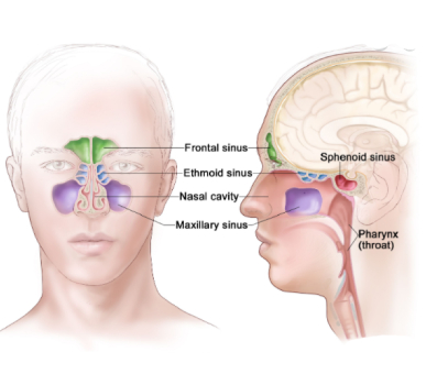 Nasal and Paranasal Sinus Cancer